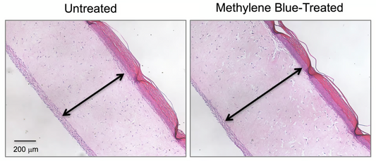 Utilisation du Bleu de Méthylène dans la Prévention du Vieillissement Cutané